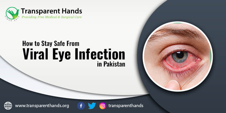 Viral Eye Infection in Pakistan 1