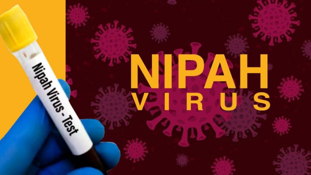 sindh health department warns about nipah virus 20231003095514